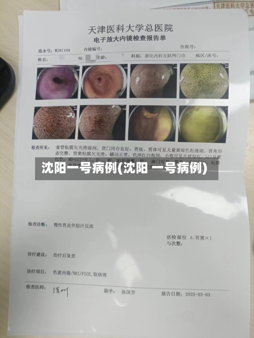沈阳一号病例(沈阳 一号病例)-第2张图片